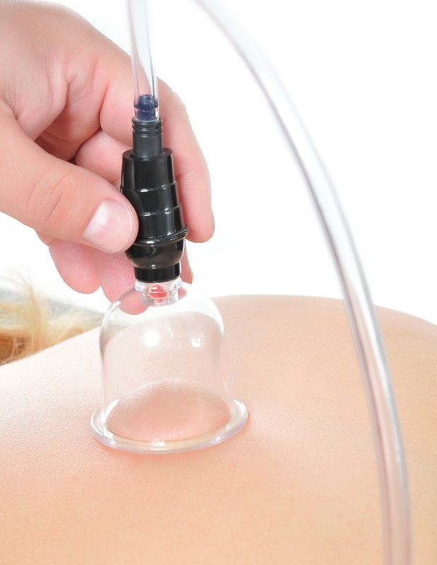 FETISH FANTASY SERIES - SET DI VENTOSE DA 6 PEZZI Fetish Fantasy Series